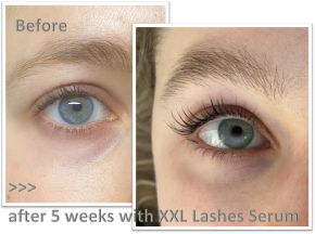 XXL Lashes Serum for Eyelash and Eyebrow Growth
